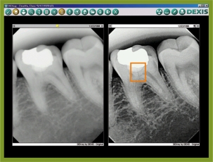 digital x rays