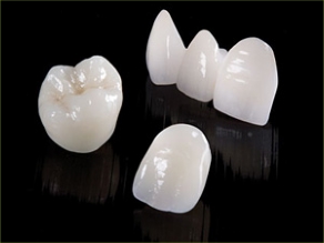 porcelain crowns